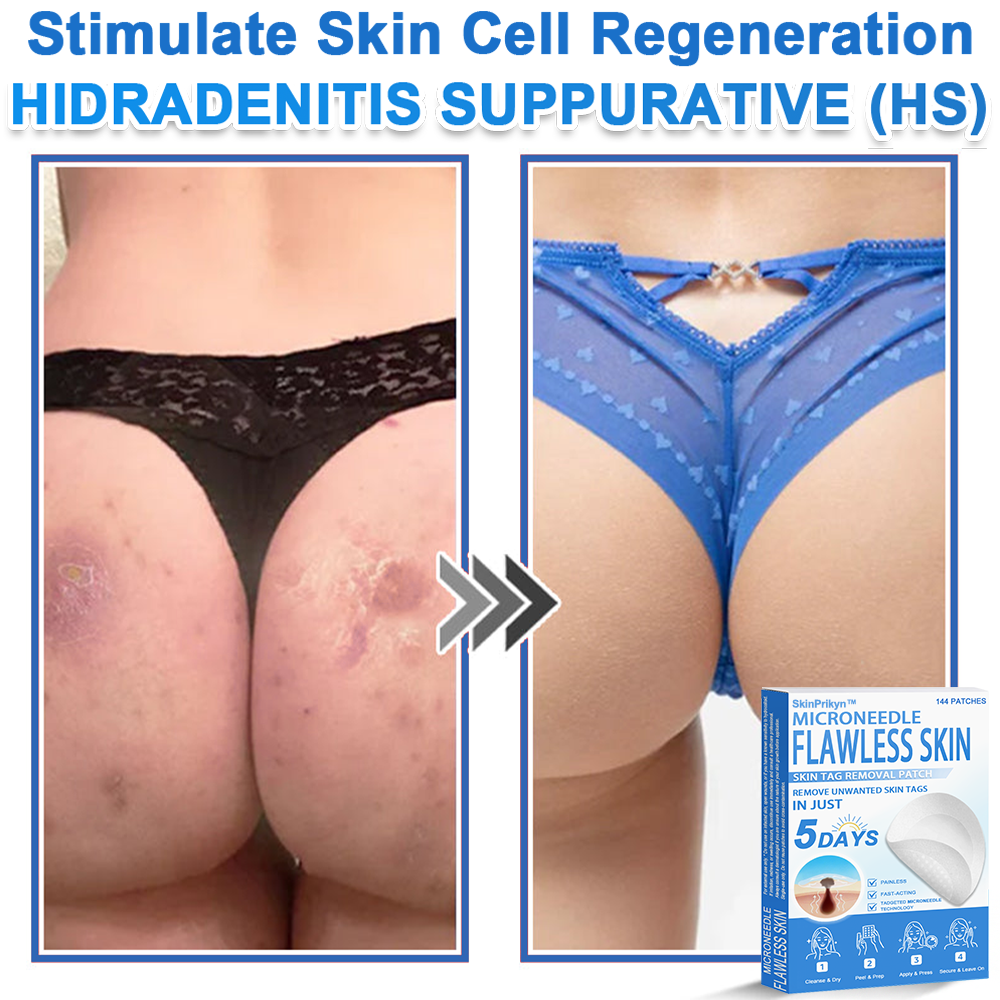 🎁 SkinPrikyn™ 2-in-1 Microneedle & Hydrocolloid Patch | Raised Moles,Acne,  Flat Warts & Skin Tags Remover | Improves Wrinkles, Scars & Blemishes | Invisible Pimple Patches for Face & Body | 144 Count