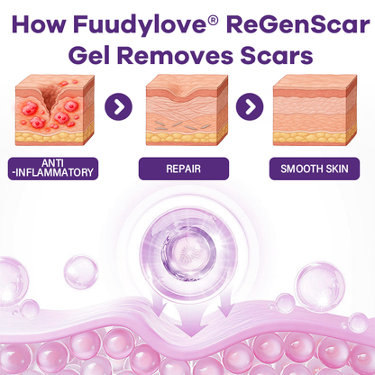 Fuudylove® ReGenScar Stem Cell Scar Gel