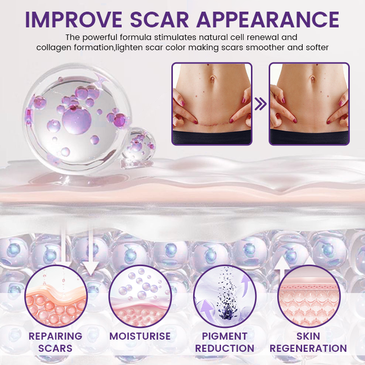 Fuudylove® ReGenScar Stem Cell Scar Gel